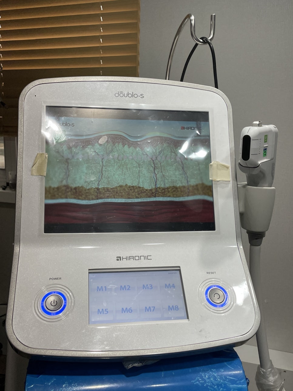 코끝연골묶기 장점과 단점 체크! 관련 이미지 5