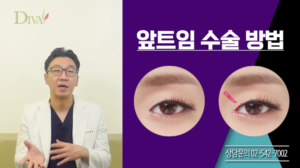 뒷트임 고민된다면 관련 이미지 2