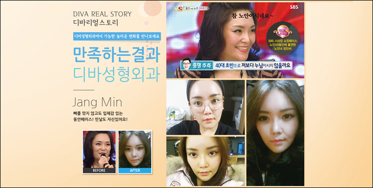 김종국형성형외과 디바와 알아보는 추억의 가요! 응답하라 1998 관련 이미지 7