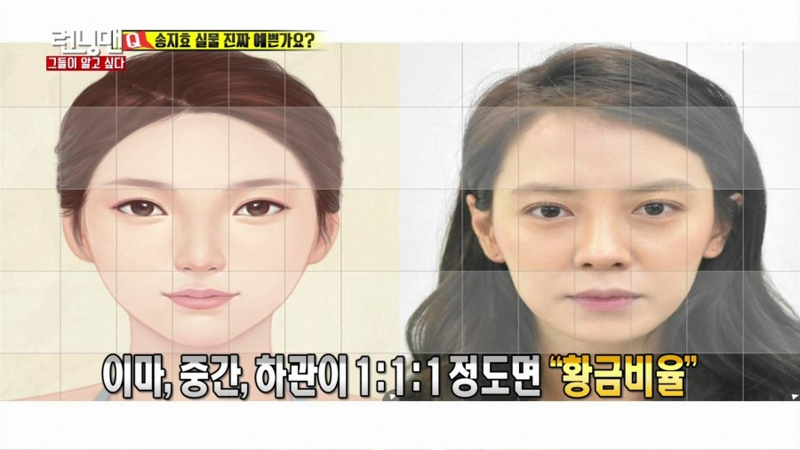 SBS 런닝맨에 출연하신 디바성형외과 김종명원장님! 관련 이미지 3