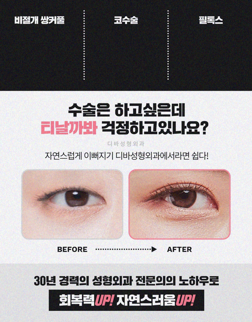 중년쌍꺼풀 노화로 인해 처진다면 관련 이미지 8