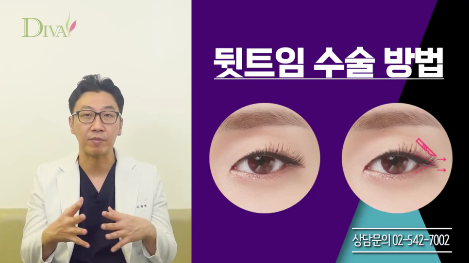 뒷트임 고민된다면 관련 이미지 4