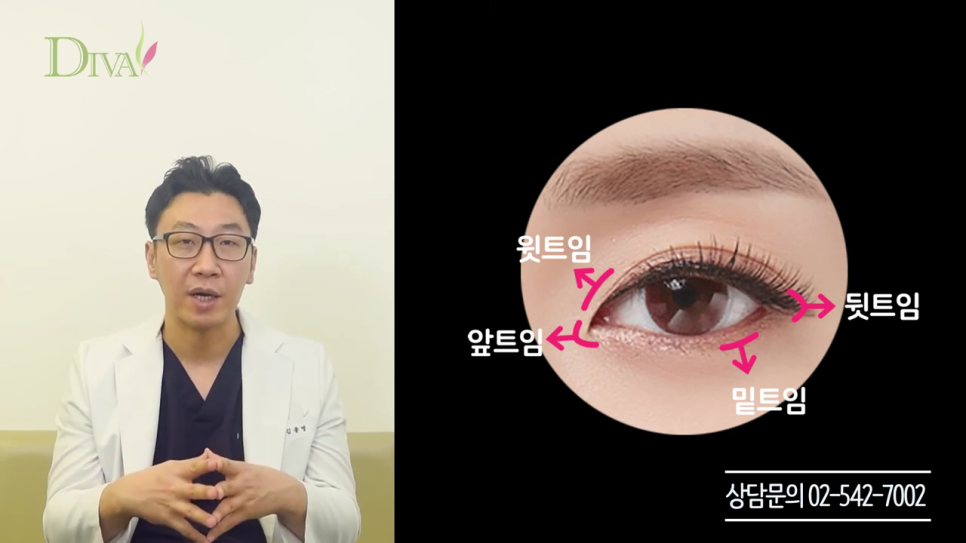 뒷트임 고민된다면 관련 이미지 6