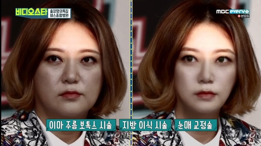 김숙가상성형, 숙이린의 탄생 스토리(?) 관련 이미지 4