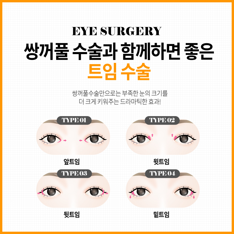 쌍꺼풀수술? 트임수술? 나에게 맞는 눈성형은? 관련 이미지 13