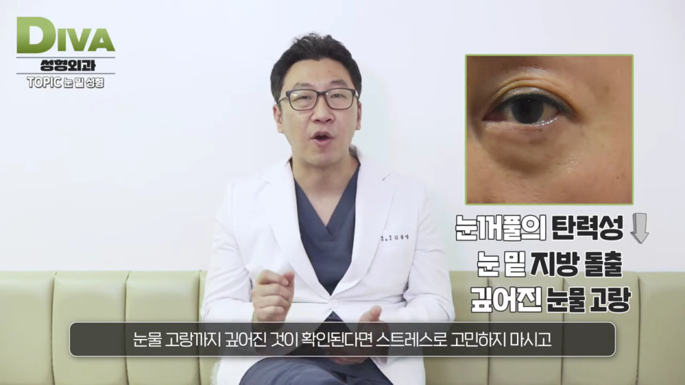 눈지방이식 어린 느낌을 살려 관련 이미지 6
