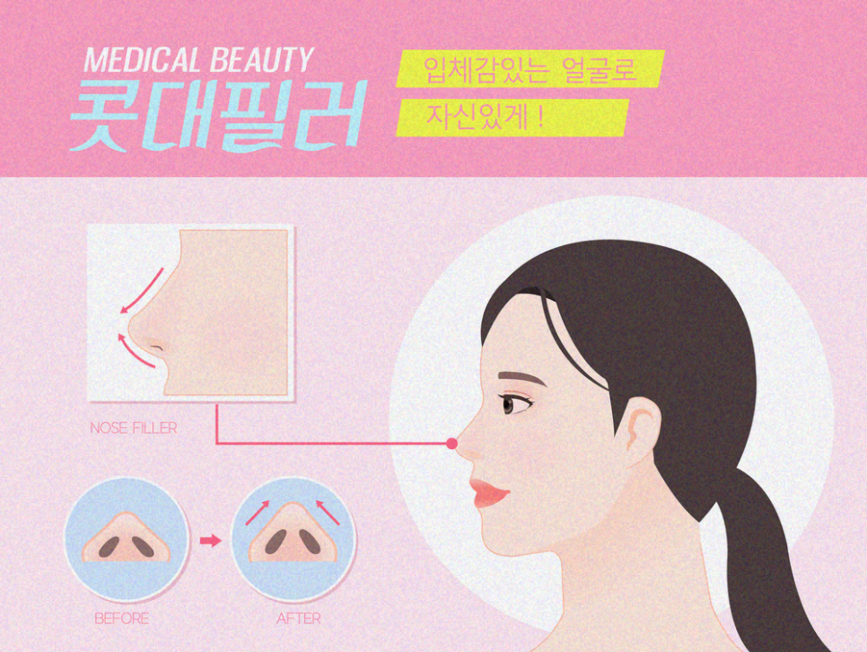 코끝성형 방법 복코를 날렵하게! 관련 이미지 10