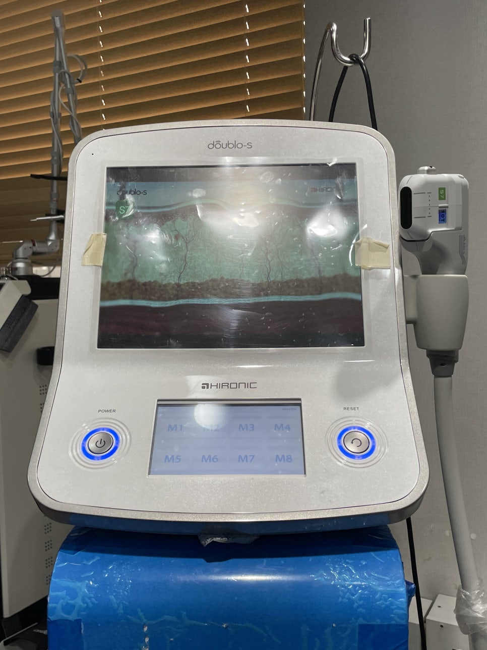 눈지방이식 어린 느낌을 살려 관련 이미지 2