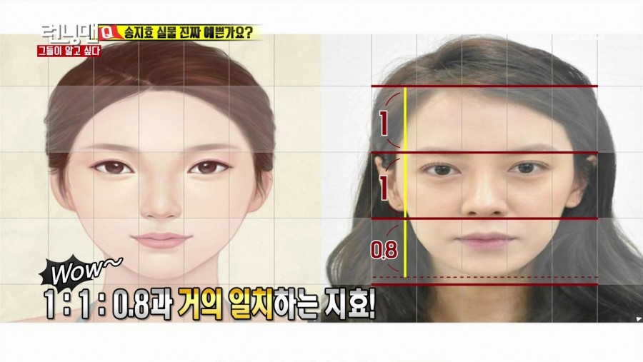 SBS 런닝맨에 출연하신 디바성형외과 김종명원장님! 관련 이미지 6