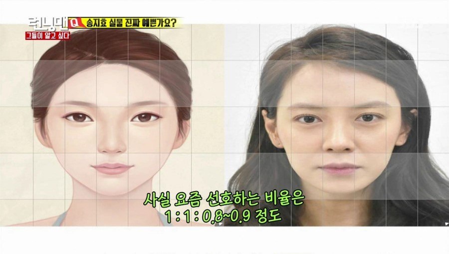 SBS 런닝맨에 출연하신 디바성형외과 김종명원장님! 관련 이미지 5