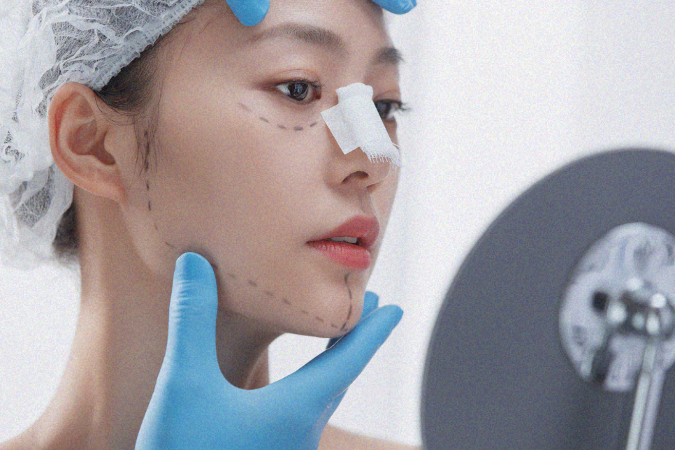 매부리코필러 수술 없이 가능할까? 관련 이미지 9