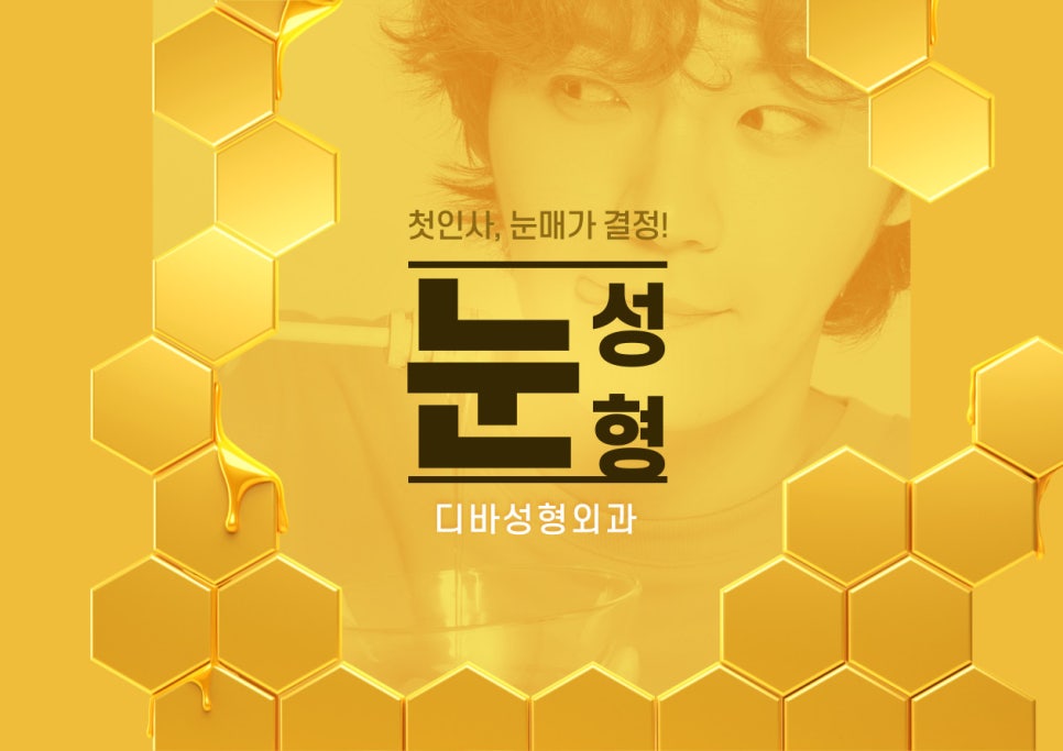 중년눈성형 눈꺼풀 처짐이 심하다면? 관련 이미지 3