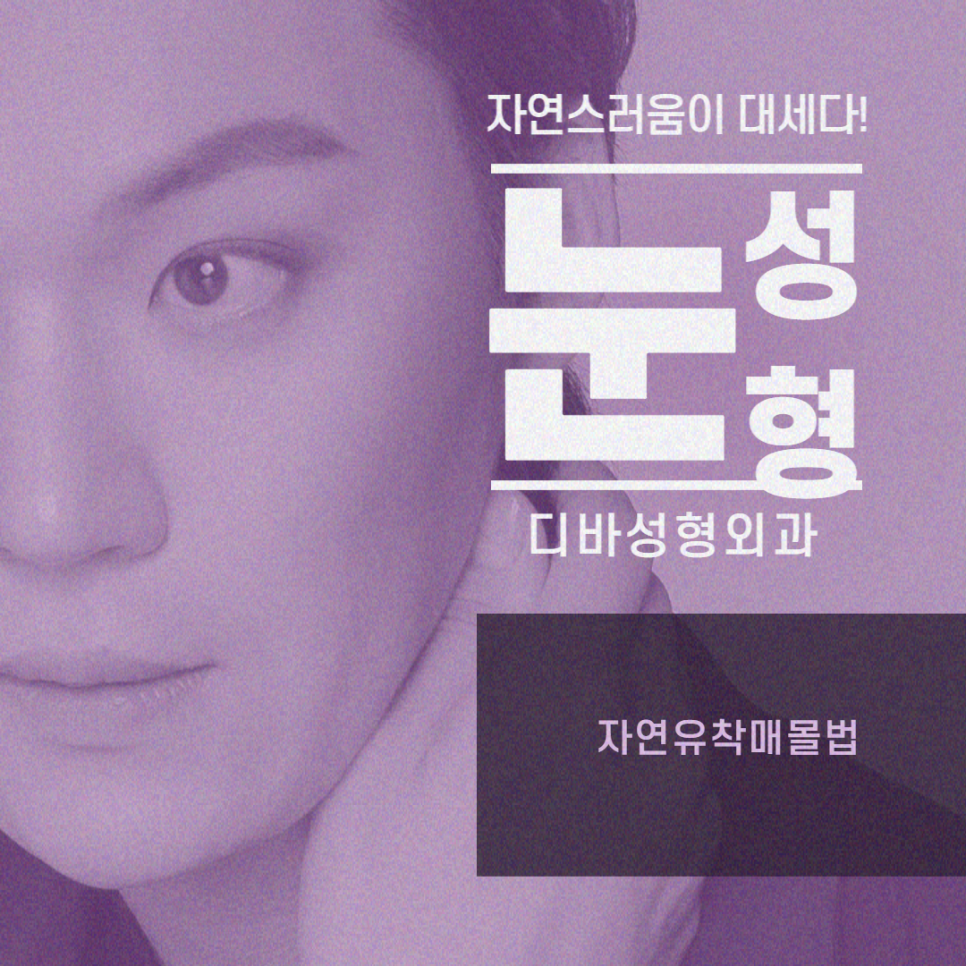 상안검수술회복기간 탄력있는 눈매는 관련 이미지 10