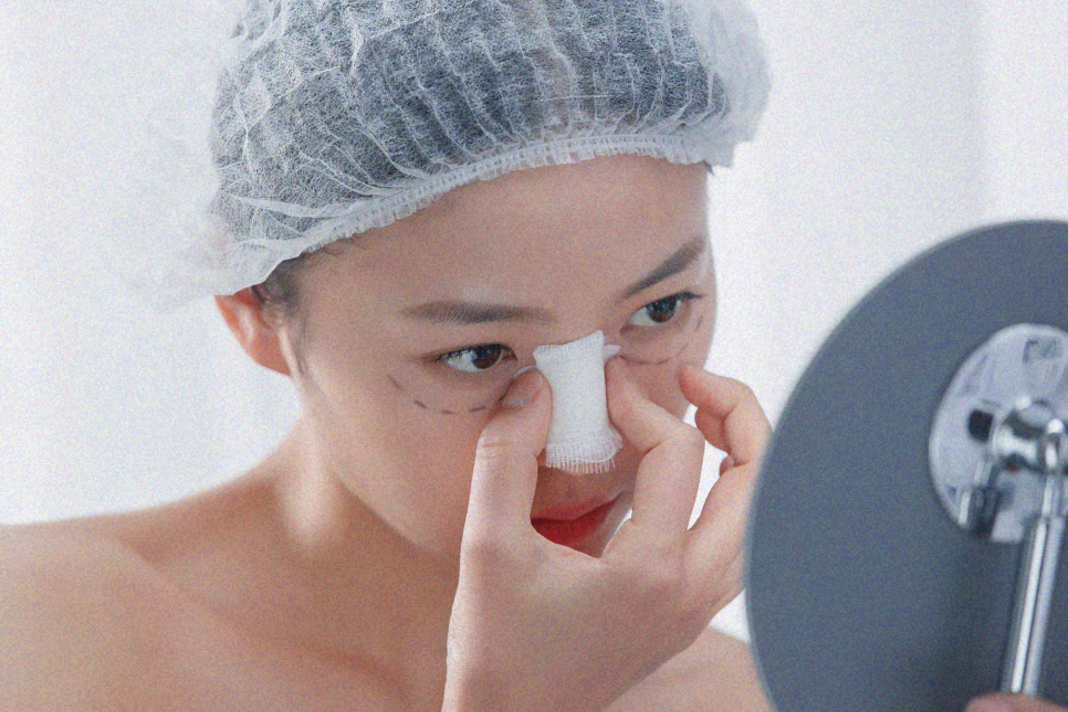 콧대수술후기 부작용 원인은? 관련 이미지 8