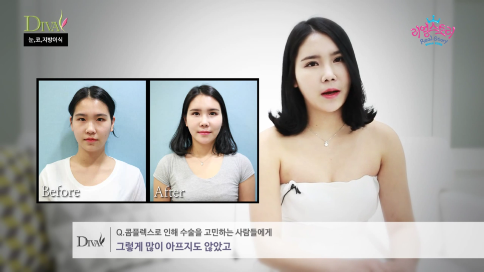 안검하수눈매교정 눈 처짐을 개선하면 관련 이미지 7