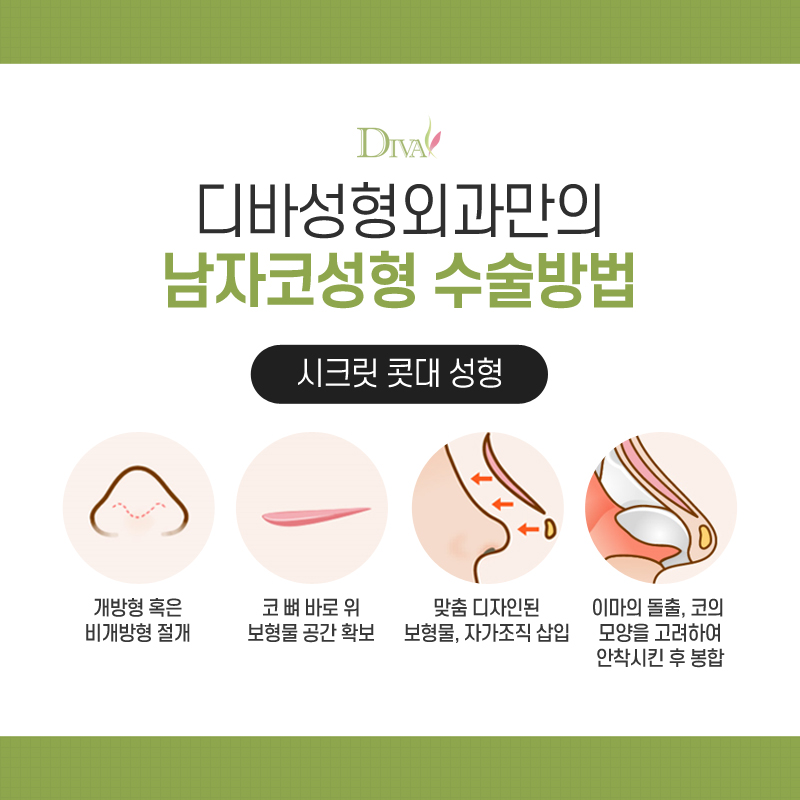 [디바성형외과] 남자코성형 얼굴의 중심을 살리다! 관련 이미지 3