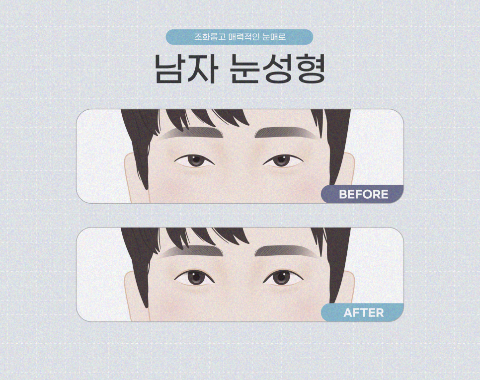 상안검 비용 회복기간 확인으로 관련 이미지 8