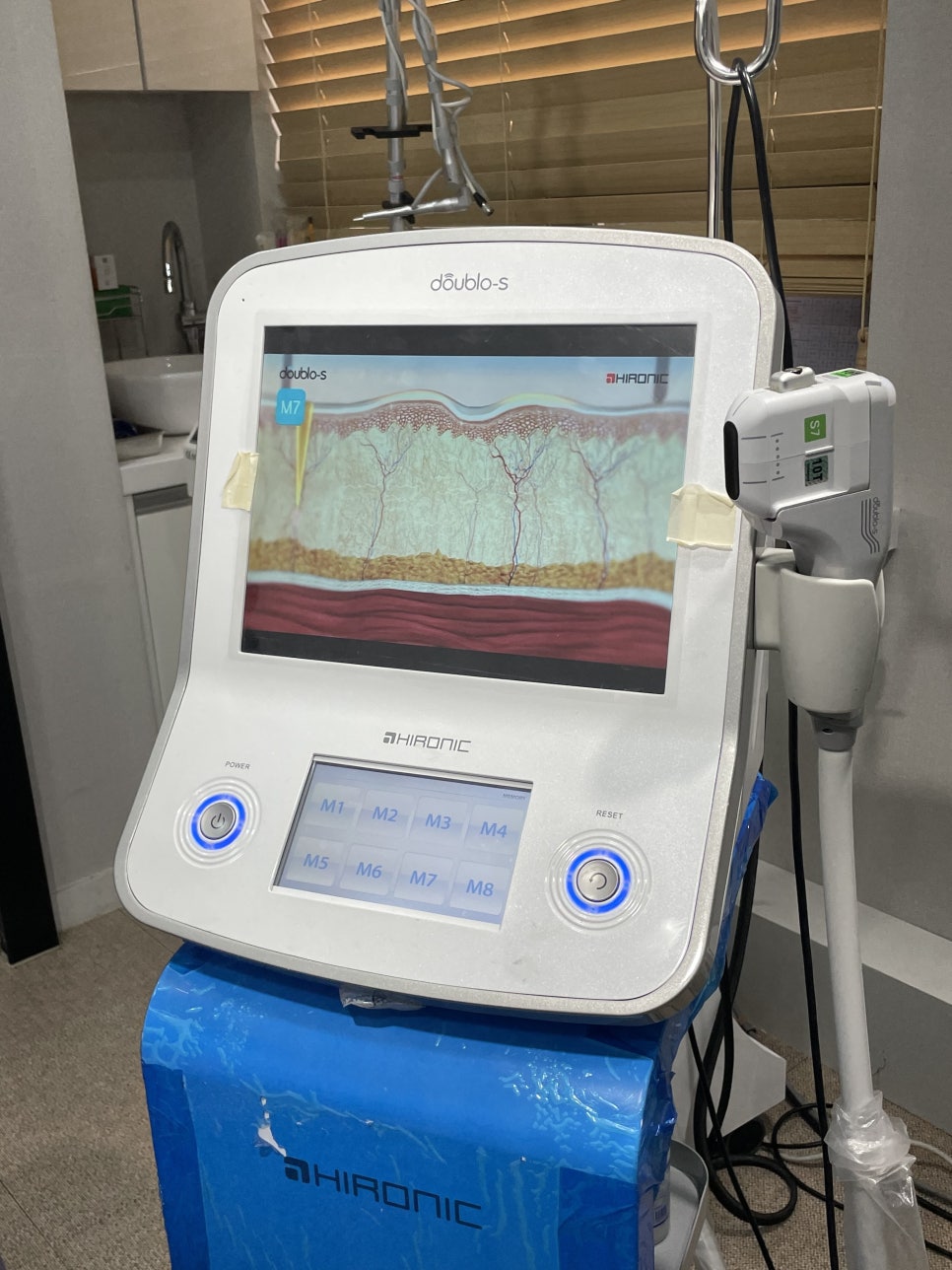 쌍꺼풀재수술 첫 수술이 실패한 원인을 알아봐요 관련 이미지 4