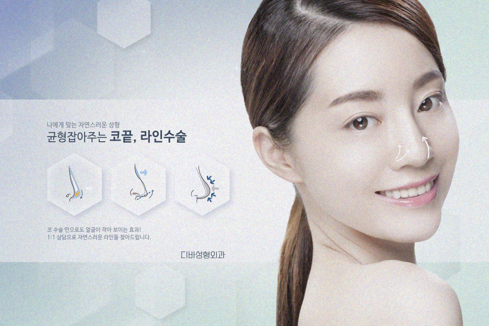 코성형가격 보다 중요한 부작용 피하는 법! 관련 이미지 9