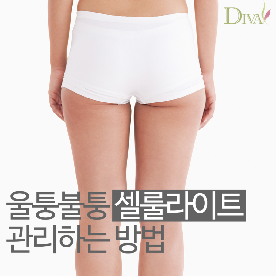 셀룰라이트 없애는 방법 뷰티꿀팁 알려드려요! 관련 이미지 1