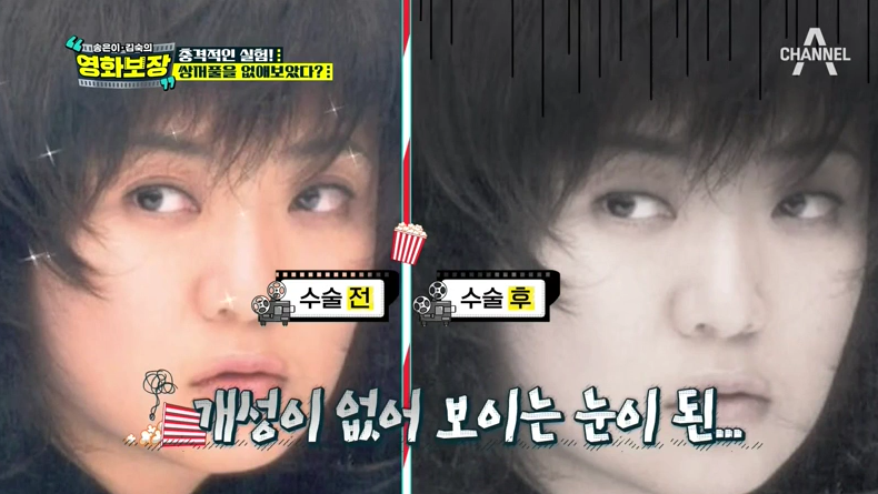 디바성형외과 &ldquo;송은이 김숙의 영화보장&rdquo;프로그램에서 김종명 원장님이 소개한 가상성형 전후 사진은? 관련 이미지 10