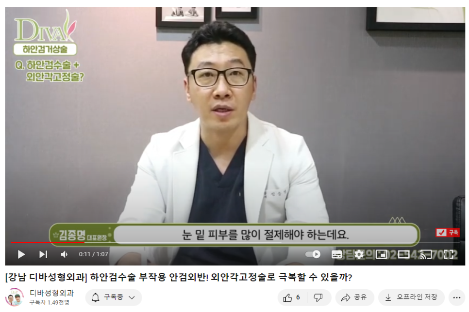 하안검수술비용 보다 중요한 체크 리스트! 관련 이미지 1