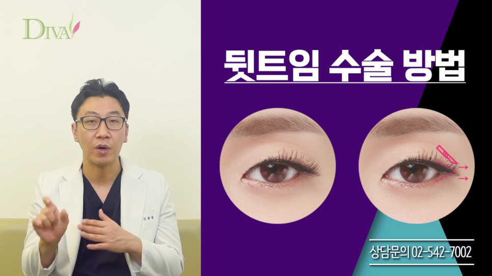 중년눈매교정 필요한 이유는 관련 이미지 4