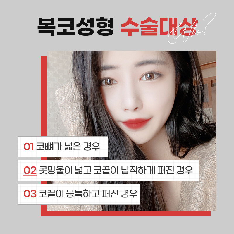 뭉툭한 복코를 개선하는 제이준 복코성형 관련 이미지 6