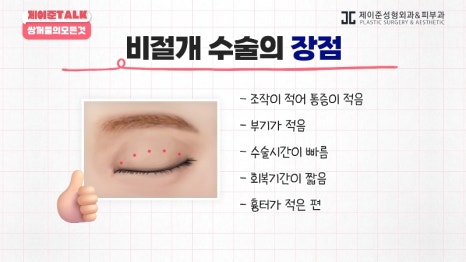 [제이준성형외과&middot;피부과] 비절개&middot;부분절개&middot;절개 쌍꺼풀의 원리와 차이점! 관련 이미지 7