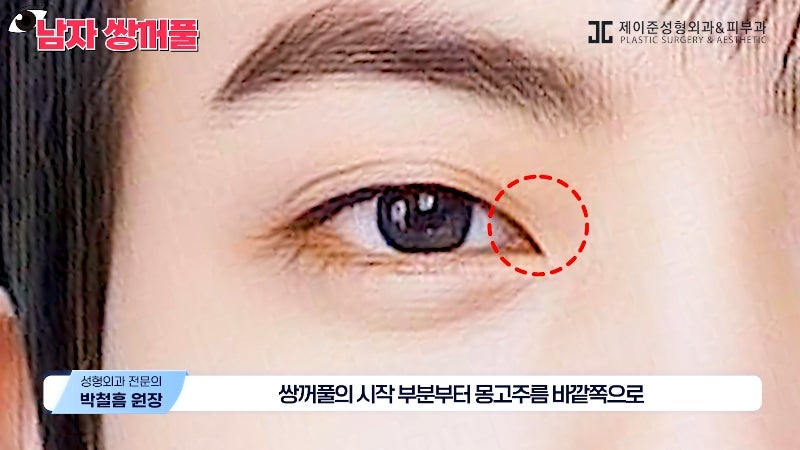 [Jeijun Plastic Surgery & Dermatology] Types and Features of Men’s Double Eyelid Lines Seen Through Celebrities! image 20