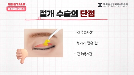 [제이준성형외과&middot;피부과] 비절개&middot;부분절개&middot;절개 쌍꺼풀의 원리와 차이점! 관련 이미지 22