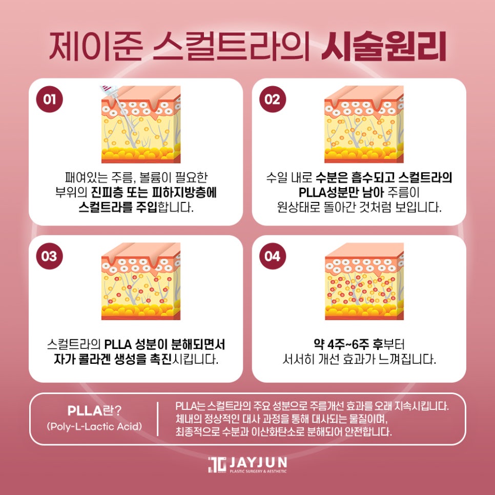 [Jayjun Plastic Surgery & Dermatology] Naturally Restoring Volume! Jayjun Sculptra Collagen Injection image 5