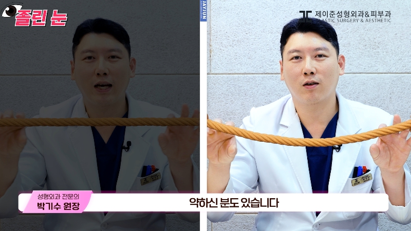 [제이준성형외과&middot;피부과] 졸려보이는 눈과 이마 주름의 상관관계? 관련 이미지 15