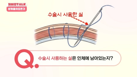 [제이준성형외과&middot;피부과] 비절개&middot;부분절개&middot;절개 쌍꺼풀의 원리와 차이점! 관련 이미지 30