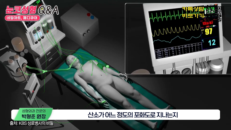 [Jeijun Plastic Surgery & Dermatology] Pre- and Post-Op Q&A: The Must-Know Guide to Eye and Nose Surgery! image 8