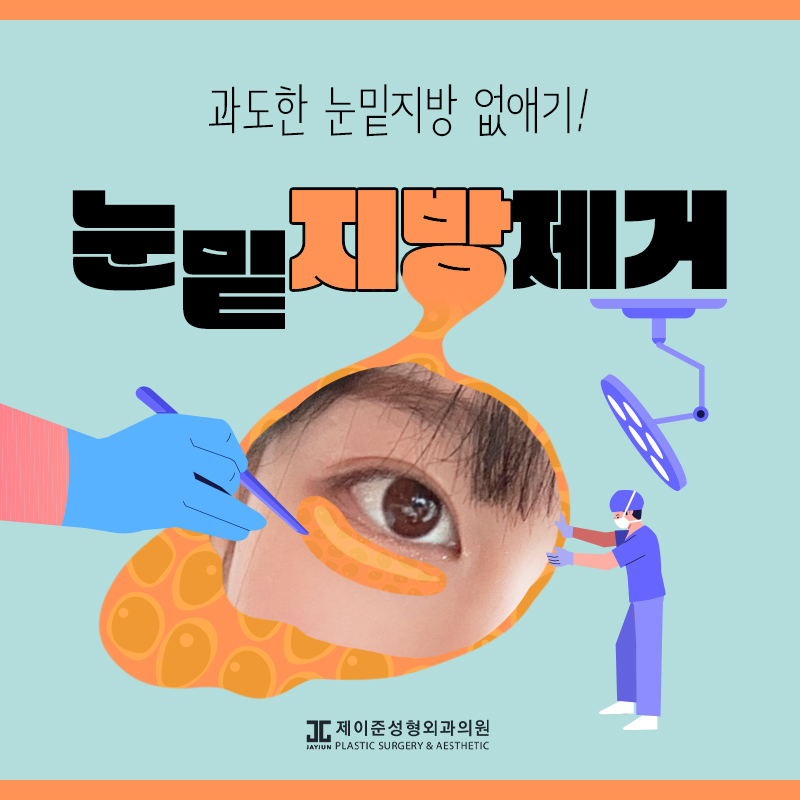 눈밑지방제거 알아보시나요? 관련 이미지 1