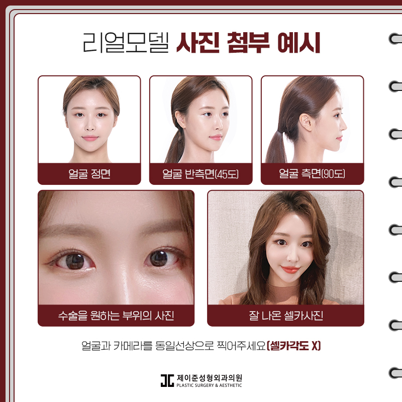 제이준성형외과 성형 모델을 모집합니다! 관련 이미지 5