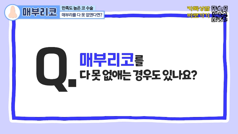 [제이준 유튜브] 유형별 코 성형, 가장 만족도 큰 매부리 코! 관련 이미지 14