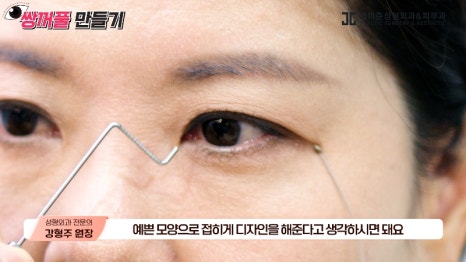 [제이준성형외과&middot;피부과] 내 눈에 찰떡인 쌍꺼풀 라인! 미리 찾아보기👀 관련 이미지 15