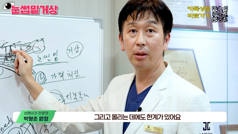 [제이준성형외과&middot;피부과] 쌍꺼풀 라인 변화 없이 눈매 개선은 확실하게! #눈썹밑거상 관련 이미지 18