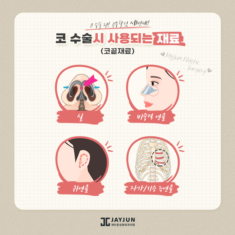 코성형, 꼭 알아야할 정보 모음 관련 이미지 6