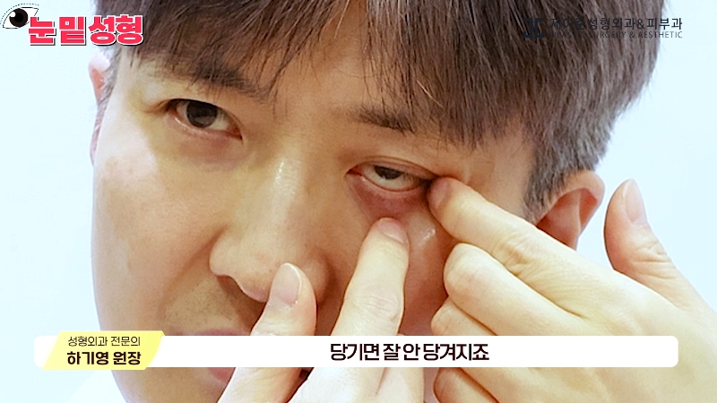 [Jeijun Plastic Surgery & Dermatology&middot;] Lower Blepharoplasty? Lower Eyelid Fat Repositioning? Read This Before Deciding! image 17