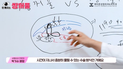 [제이준성형외과&middot;피부과] 쌍꺼풀 수술 vs 쌍꺼풀+눈매교정! 눈매교정 함께 하면 좋은 이유! 관련 이미지 5