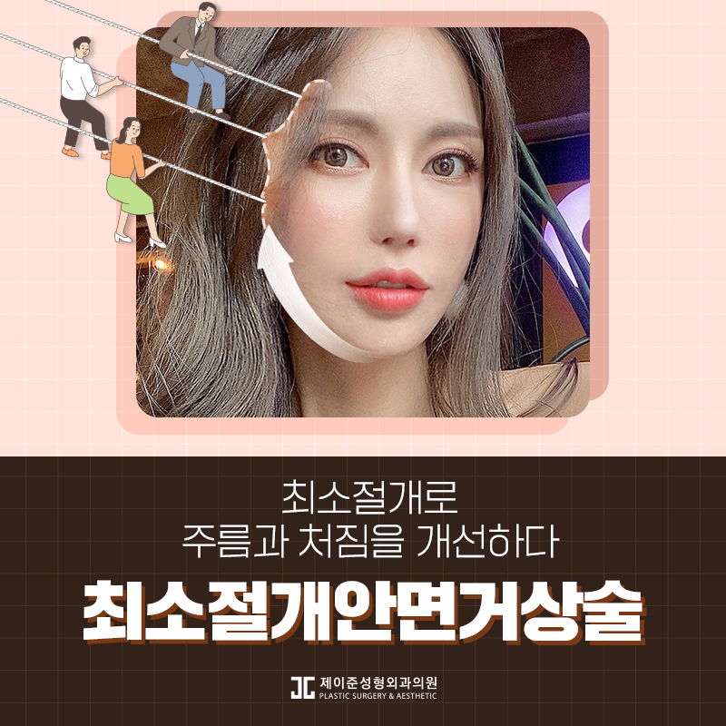 최소절개안면거상술 어떤 수술일까? 관련 이미지 1