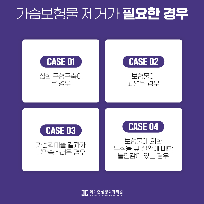 가슴보형물제거 어떤 수술일까? 관련 이미지 2