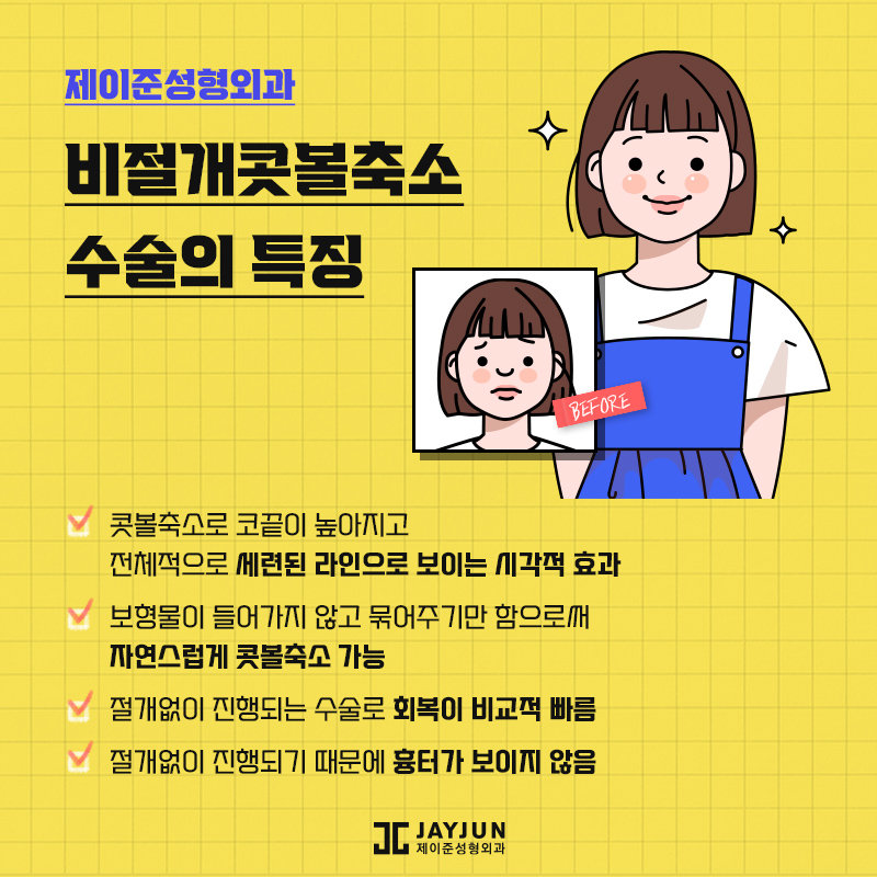 제이준의 비절개콧볼축소 , 콧볼축소 차이점 관련 이미지 6
