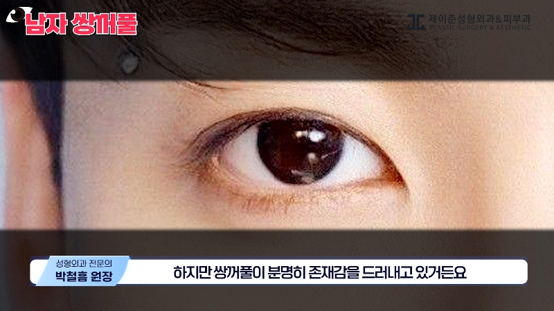 [Jeijun Plastic Surgery & Dermatology] Types and Features of Men’s Double Eyelid Lines Seen Through Celebrities! image 11
