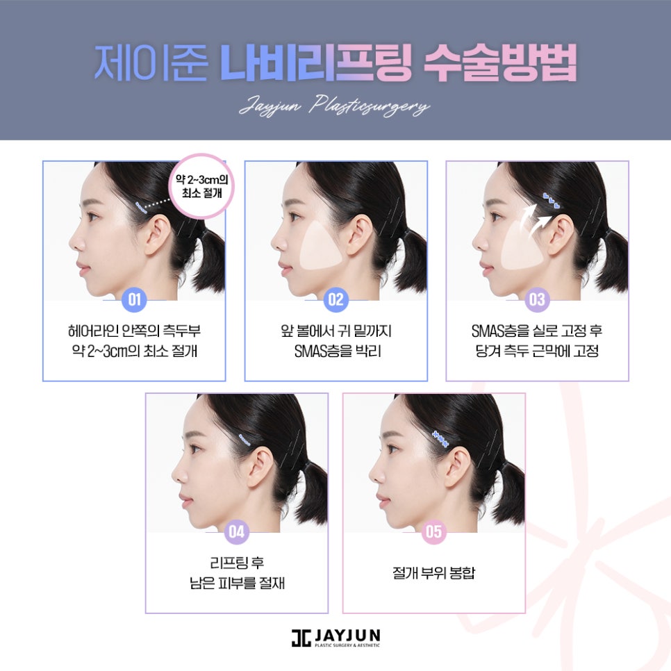 #중안면부 #나비존 #최소절개리프팅 제이준 나비리프팅 관련 이미지 7