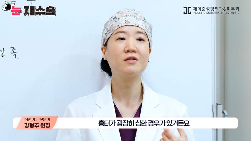 [Jeijun Plastic Surgery &amp; Dermatology] Everything a plastic surgery specialist wants you to know about eyelid revision surgery! Customized methods by case! image 12