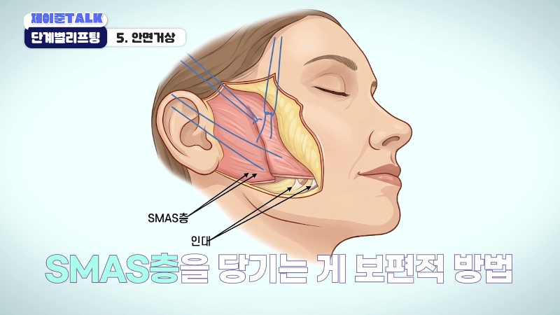[제이준성형외과&middot;피부과] 보톡스부터 안면거상까지, 내 처짐 수준에 맞는 리프팅 선택법 관련 이미지 26